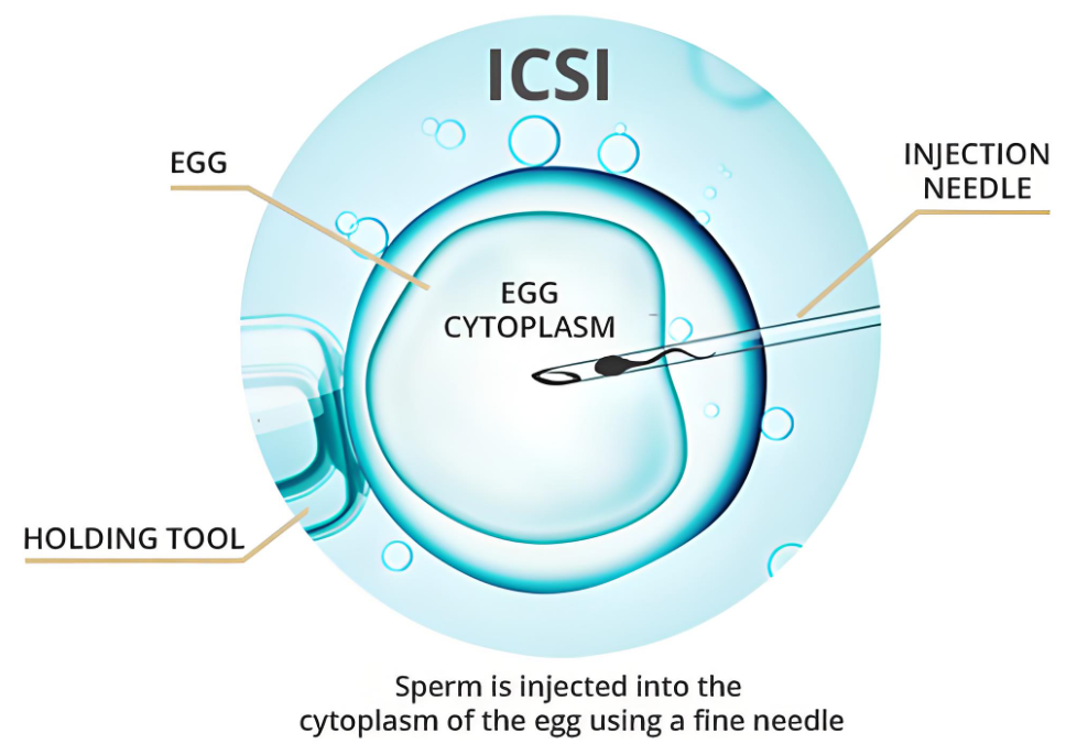 8例行IVF/ICSI助孕患者成功妊娠率分析