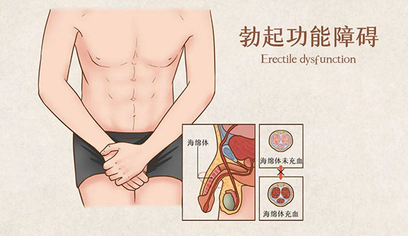 “他达拉非5mg每日一次治疗勃起功能障碍”中国专家共识