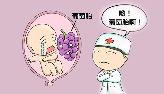 葡萄胎诊治中国专家共识（2024年版）