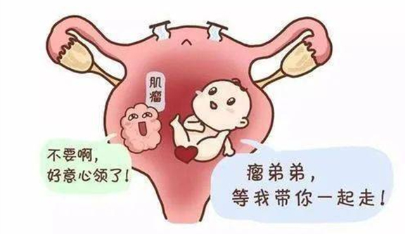 妊娠期子宫蜕膜息肉诊治中国专家共识（2024年版）